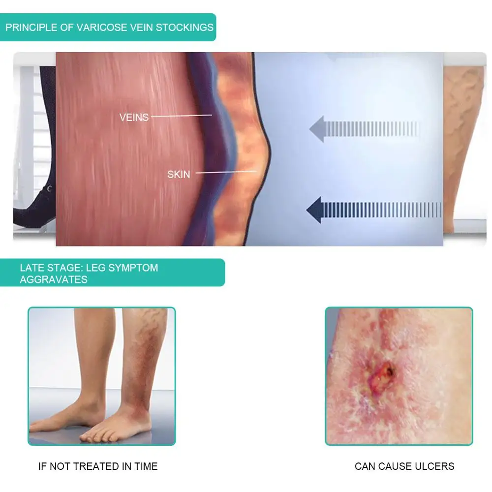 1 쌍 의료 압축 양말 30-40mmHg 중간 튜브 얇 - Compression Sleeve Calf 리뷰 및 가격
